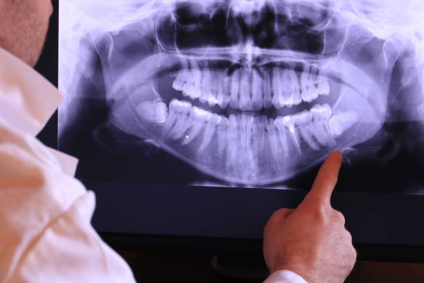 Best Emergency Gum Pain Relief  in Florence, TX