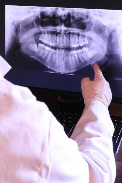 Best Dentist for Tooth Abscess  in Florence, TX